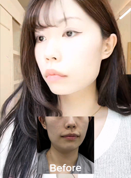 인스타 5